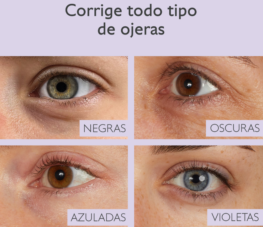 ojeras-caudalie.png