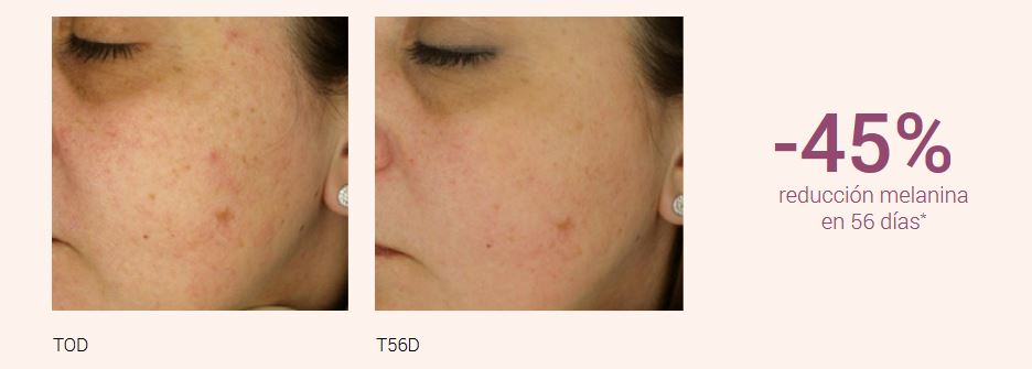 pruebas-de-eficacia-singuladerm-radiant-dual-serum-30-ml.JPG