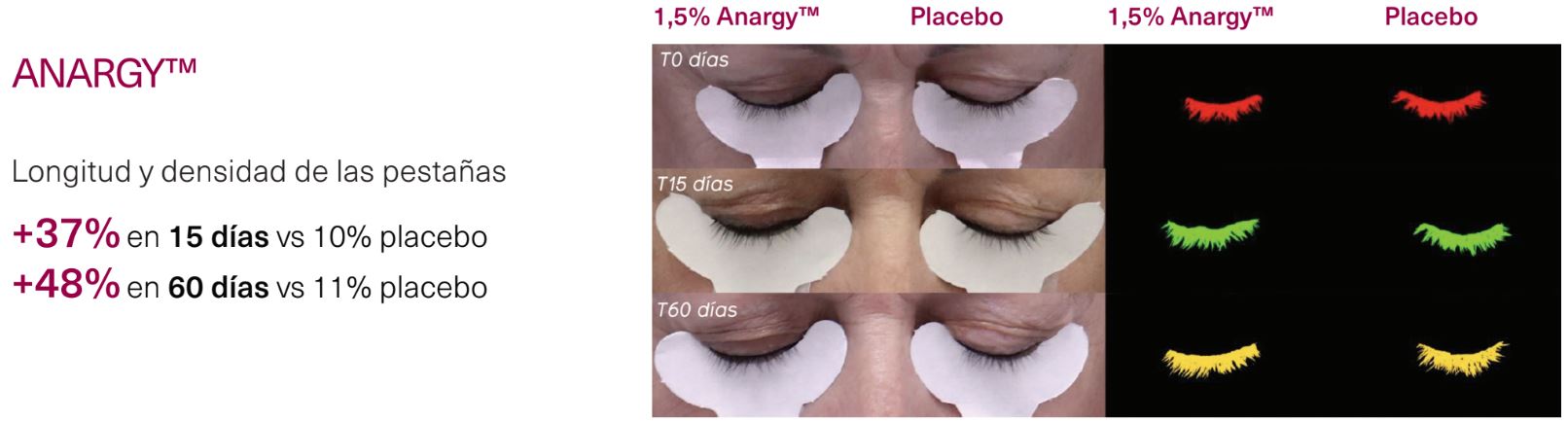pruebas-de-eficacia-singuladerm-xpert-lashes.JPG